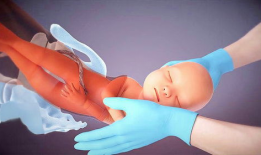 顺产真实视频,见证生命诞生的震撼时刻