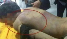 尸检视频,还原死亡真相的惊心动魄瞬间